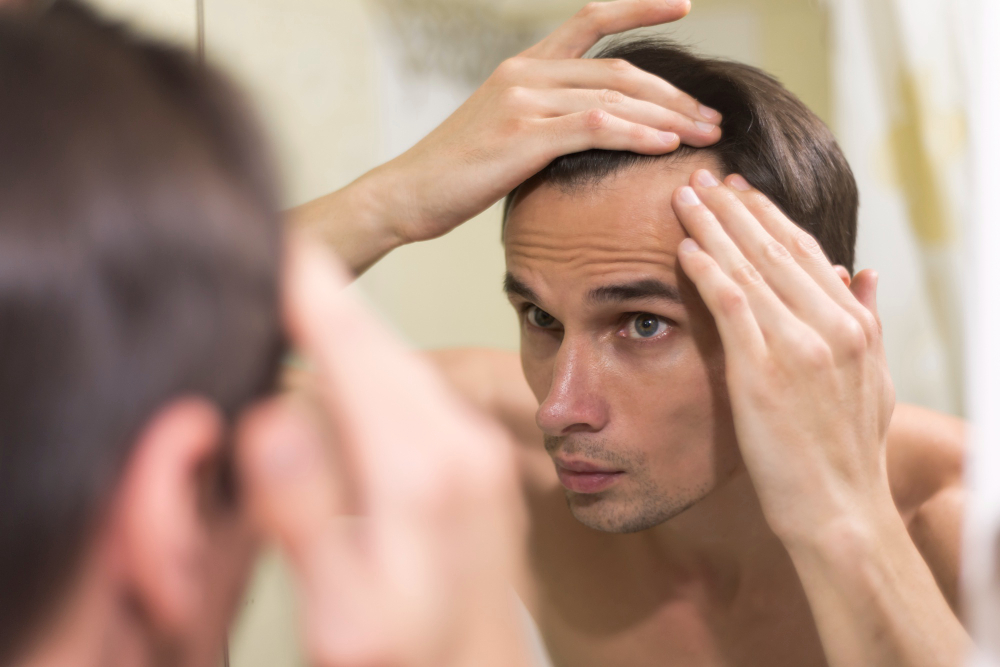 Hair Loss In Men 1